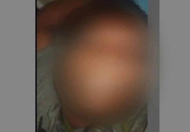 Hyderabad