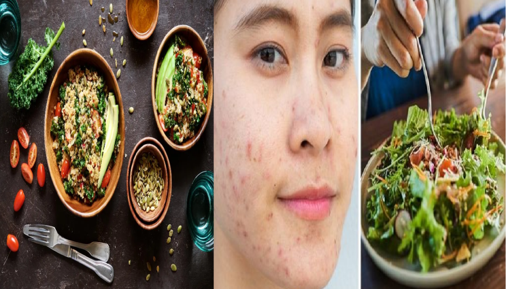 Common Dietary Triggers of Acne