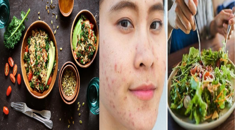 Common Dietary Triggers of Acne