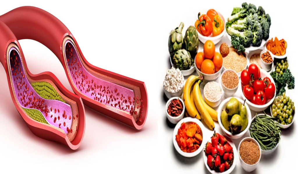 How to reduce bad cholesterol: Bad cholesterol can cause heart attack